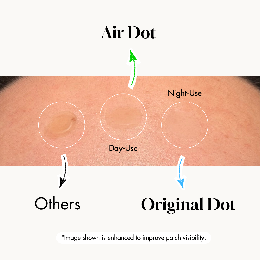 STIK Acne Rescue Kit: Air Dot next to Original Dot and others on skin