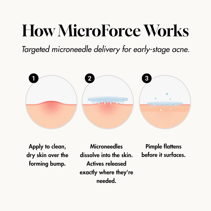 STIK Acne Rescue Kit: How MicroForce works