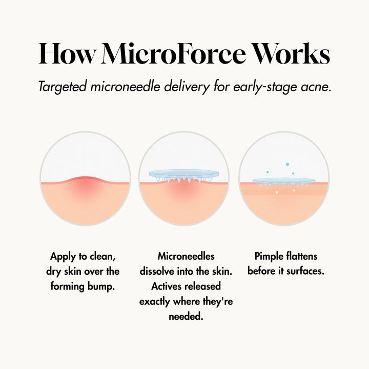 MicroForce for Early Acne