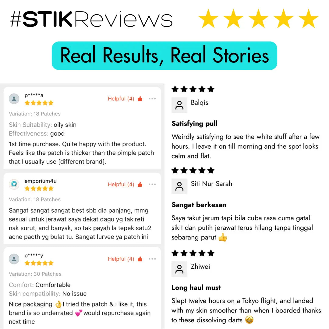 MicroForce for Whiteheads